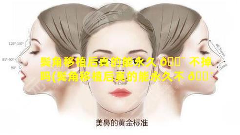 鬓角移植后真的能永久 🐯 不掉吗(鬓角移植后真的能永久不 🌴 掉吗图片)